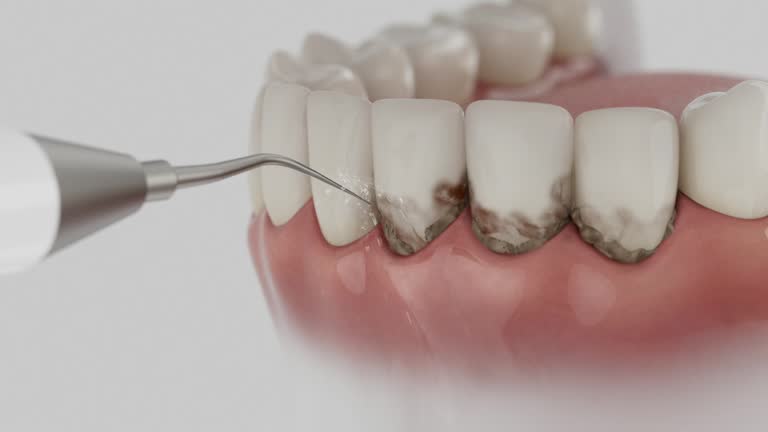 Trusted Tooth Extraction service in Buchanan, VA - Dentist Open Now